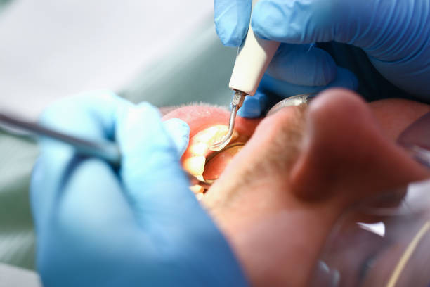 Best Cosmetic Emergency Dentistry in Coldwater, MI